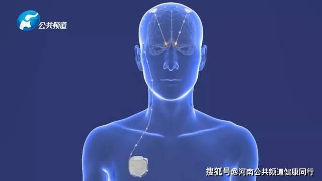 梅杰症的最新治疗方法,梅杰症的最新治疗方法,曙光初现的希望之光,梅杰症最新治疗方法,曙光初现的希望之门
